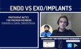 Endodontics vs Implants with Omar Ikram