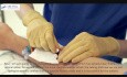 Venous Access Made Easy Video (4)