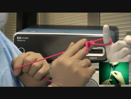 Extra Corporeal Roeder's Knot