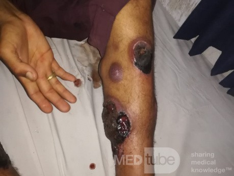 Identifying Lesions