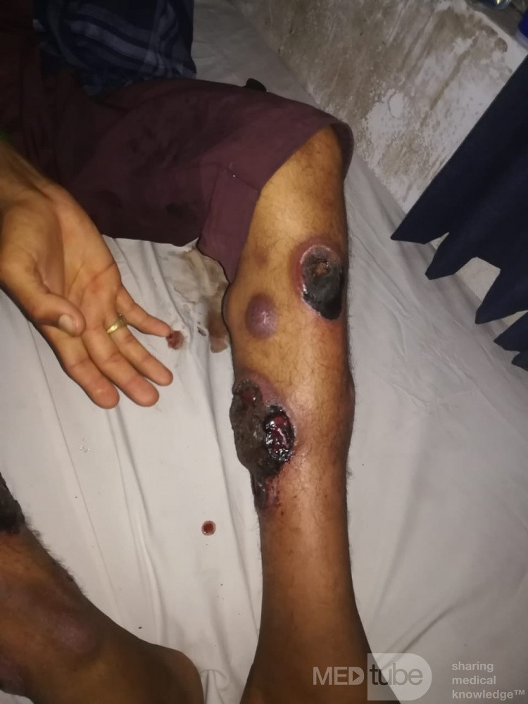 Identifying Lesions