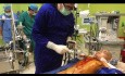 Retinoblastoma Metastasis to the Heart 