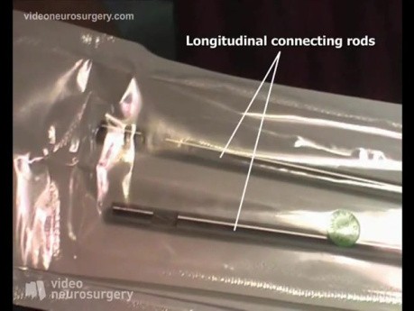 Lumbar Dynamic Arthrodesis Surgery - Posterior Lateral Approach