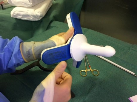 Treatment of Bleeding and Prolapsed Piles with Non Excisional Technique