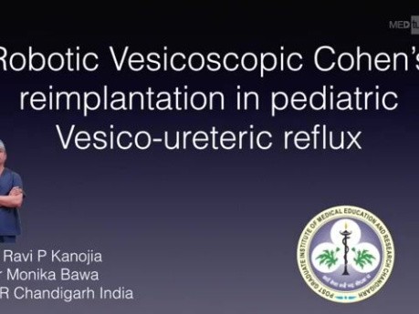 Robotic Vesicoscopic Cohen’s Reimplantation For Pediatric Vesicoureteric Reflux