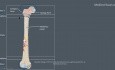 Guz olbrzymiokomórkowy kości - Patologia