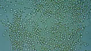 Microbiological Testing Of Feces - Candida