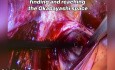 Okabayashi Space Dissection for Endometriosis 