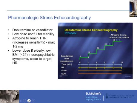 Stress Echo & Assessment of CAD: An Overview