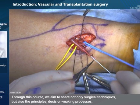 Vascular and Endovascular Surgery Skills