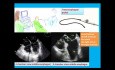 A Simple Transesophageal Echocardiography Quiz and Introduction to Tee Views (Toe)
