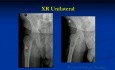 Orthopedic Oncology Course - Unknown Test Cases Part B (Cases 11-20) - Lecture 12