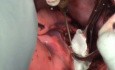 Echinococcosis hidatid cysts