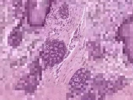 Tongue Foliate Papilla - Histology