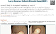 Large Inverted Colonic Diverticulum (LICD)
