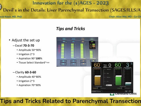 Tips and Tricks Related to Parenchymal Transection