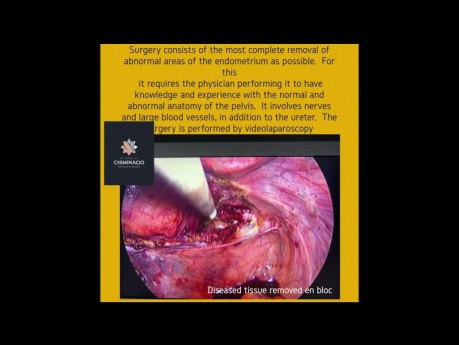 Endometriosis Booklet