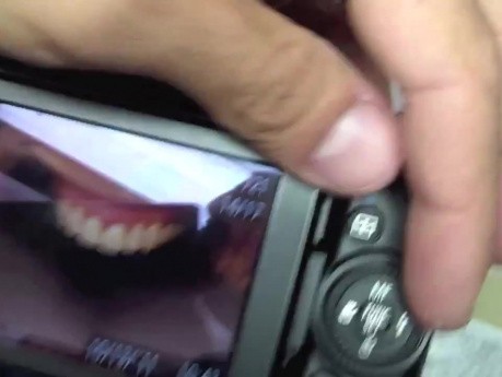 Take Better Anterior Maxillary Intraoral Photos