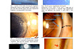 Fluid Channels of Cornea and Conjunctiva