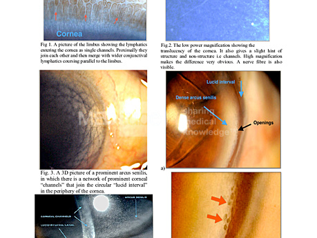 Fluid Channels of Cornea and Conjunctiva