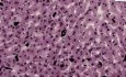 Liver Kupffer Cells - Histology