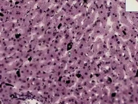 Liver Kupffer Cells - Histology
