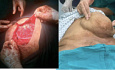 OSCE Slide Examination