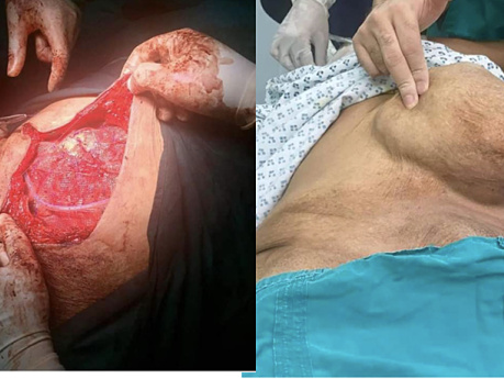OSCE Slide Examination