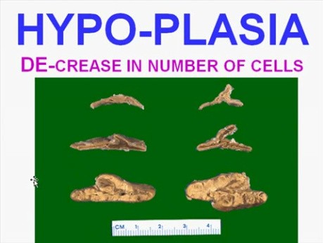 Cellular Adaptations, Cell Injury and Cell Death - MSP - 1b