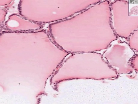 Thyroid - Histology