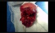 Diagnosing Abnormal Conception (Ectopics, Hydatidiform mole etc) on Ultrasound