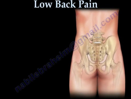 Sacroiliac Joint - Low Back Pain Cause - Video Lecture