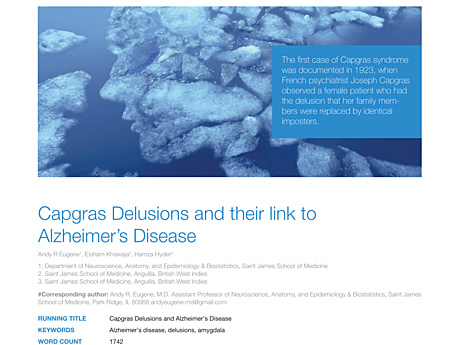 MEDtube Science 2013 - Capgras Delusions and their link to Alzheimer’s Disease