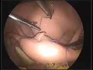 EVE ETX- laparoscopic surgeries simulator
