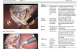 Redefining Safety in Laparoscopic Cholecystectomy: Insights into the Madany’s Triangle Technique with a Critical Appraisal