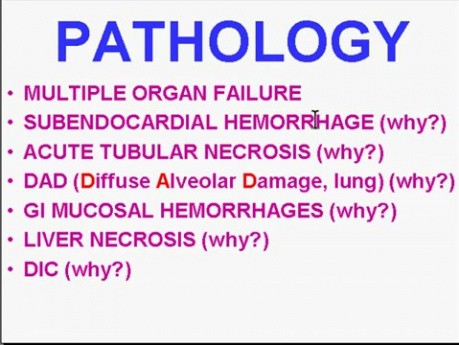 Hemodynamic Disorders, Thromboembolic Disease and Shock - MSP - 4k