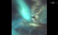 RIRS Lower Calyceal, Suction Effects