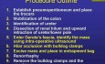 Left Laparoscopic Partial Nephrectomy - Part 2