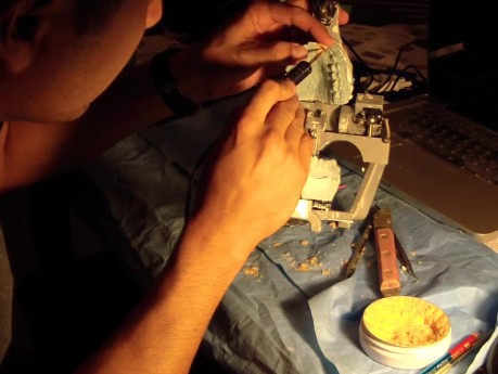Diagnostic Waxup Part 4