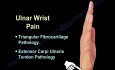 Causes of the Wrist Pain - Video Lecture