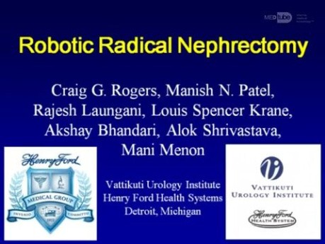 Robotic Radical Nephrectomy For Kidney Cancer