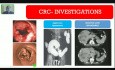 Colorectal Carcinoma - Lower GI Hemorrhage