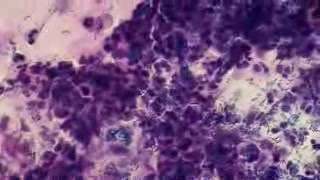Phagocytosis