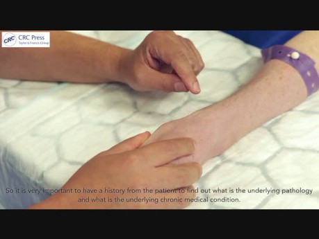 Venous Access Made Easy (1)