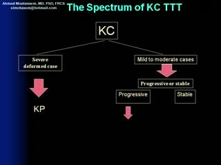 Keratoconus