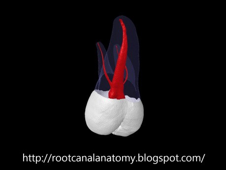 Maxillary Second Molar