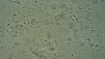 Postcoital Test (PCT) - In Vivo - 3h