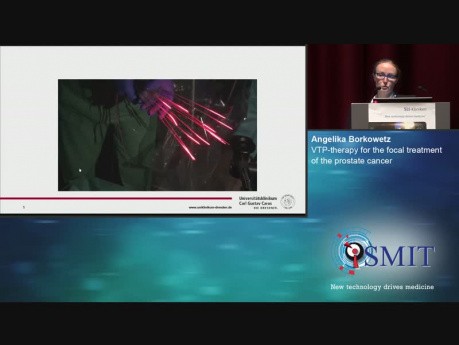 VTP-Therapy for the Focal Treatment of the Prostate Cancer - SMIT 2019