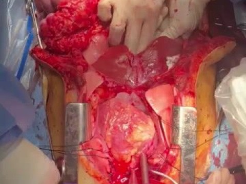 General Surgery 