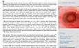 Hysteroscopy Newsletter vol 3 Issue 4